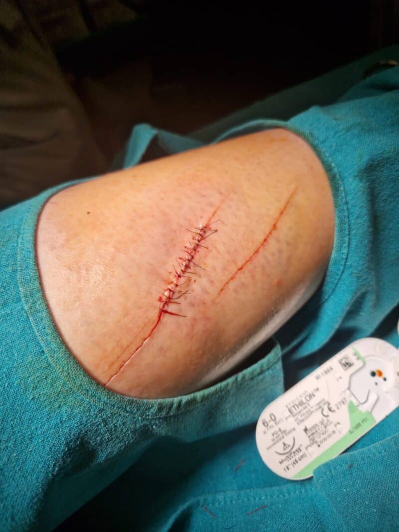 Zwangspause für Franziska Fries (NÖ)! Die 32-jährige Grand-Prix-Reiterin muss nach einem Schnorchel-Unfall pausieren. © Privat